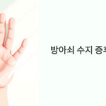 방아쇠 수지 증후군 증상