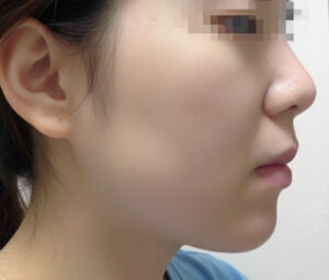 판토텐산  복용후기 좋아짐