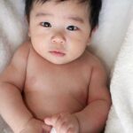 아기피부에 신경섬유종 증상 원인 및 치료