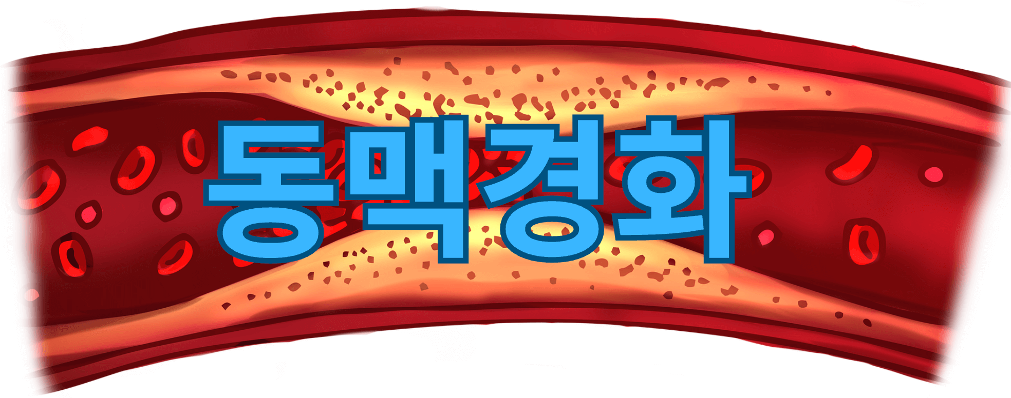 동맥경화 예방음식