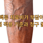 하지정맥류 보험적용