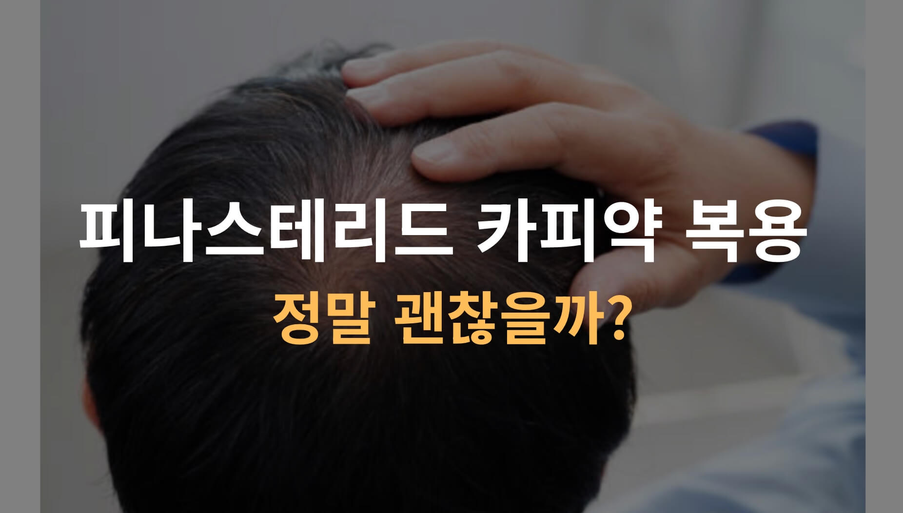 피나스테리드 카피약 복용