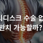 허리디스크 비수술 치료와 척추 통증 완치를 위한 5가지 허리디스크 관리법 인포그래픽. 도수치료와 재활 등 수술 없이 통증을 잡는 정확하고 효과적인 해결책 제시.