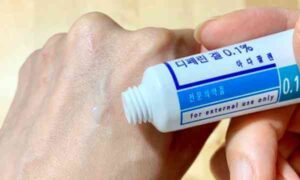 디페린겔 사용법 8단계 가이드로 아다팔렌 성분을 활용해 좁쌀 여드름을 개선하고 피부 자극을 줄이는 올바른 저녁 루틴을 확인하세요.