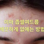 이마 좁쌀여드름 원인 해결을 위해 묵은 각질과 피지를 제거하여 매끄러운 피부를 만드는 3가지 전문 치료법과 흉터 예방 관리 가이드