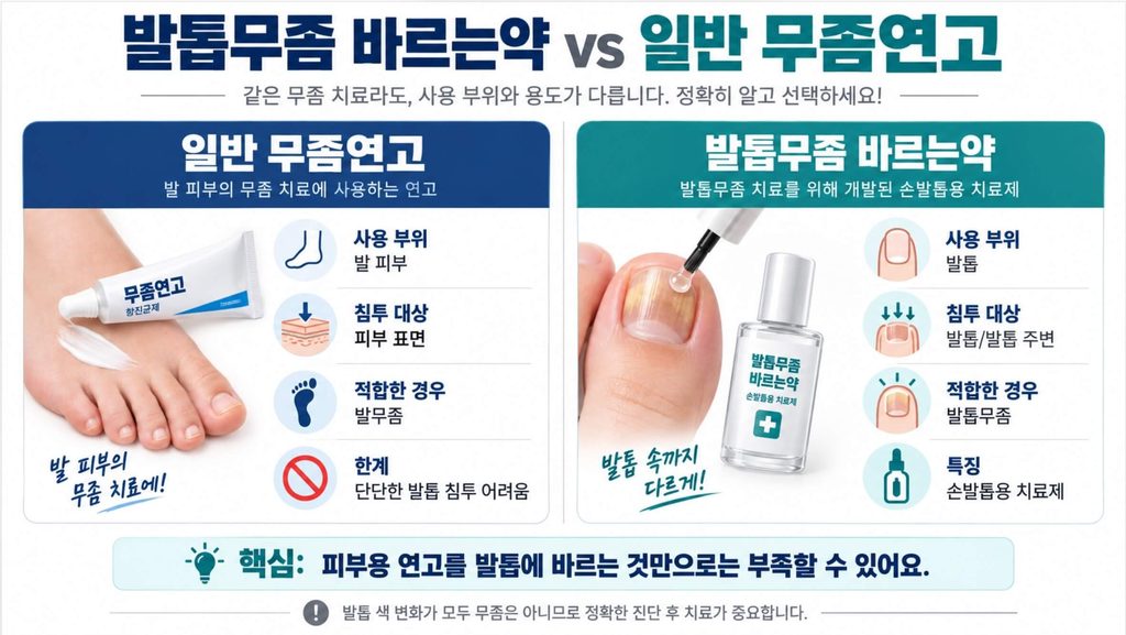 발톱무좀 바르는약 피부용 무좀약 비교